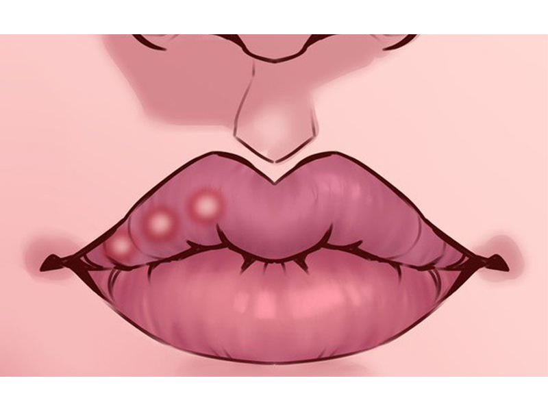 8-dau-hieu-tren-moi-bao-canh-bao-suc-khoe-dac-biet-chu-y-vet-cham-den