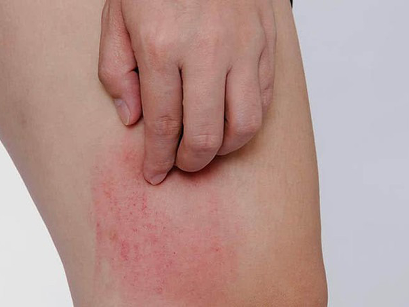 de-y-trieu-chung-2-ngua-1-den-tren-co-the-bao-hieu-ung-thu-gan-den-gan