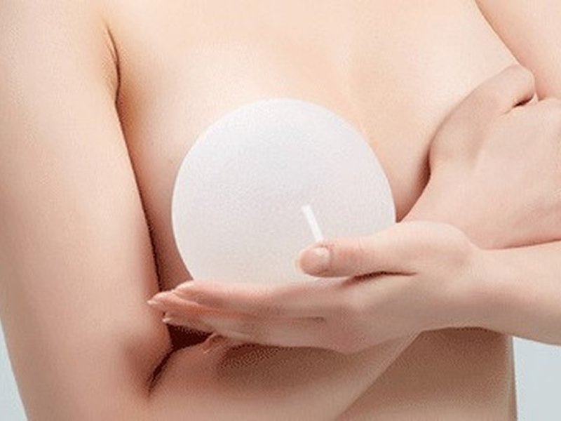 nguc-co-gai-tre-to-gap-4-suyt-no-sau-khi-nang-nguc-o-tham-my-vien