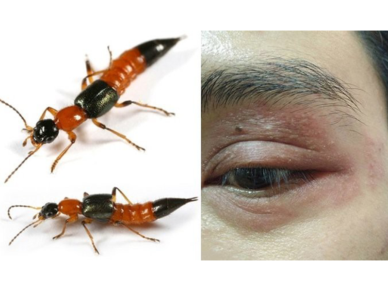 noc-kien-ba-khoang-doc-hon-ran-ho-15-lan-cach-chua-the-nao